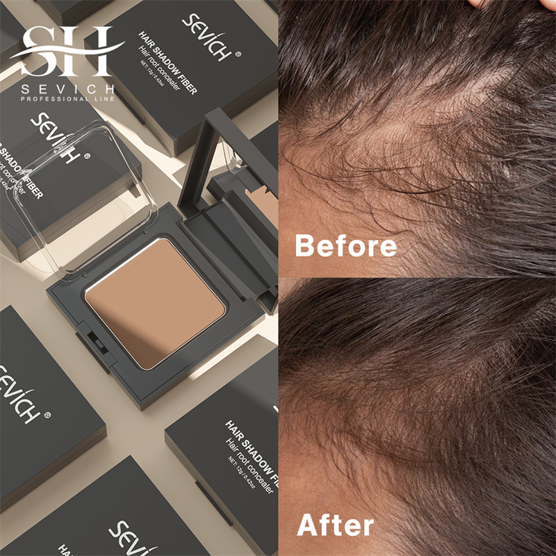 SEVICH 12g Hairline Powder Wit - Rooting Hormone Powder incelemesi ve fiyatı